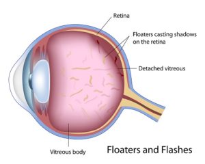 Retina Diagram